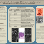 reflectance confocal microscopy poster