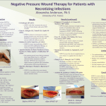 online poster about negative pressure wound therapy